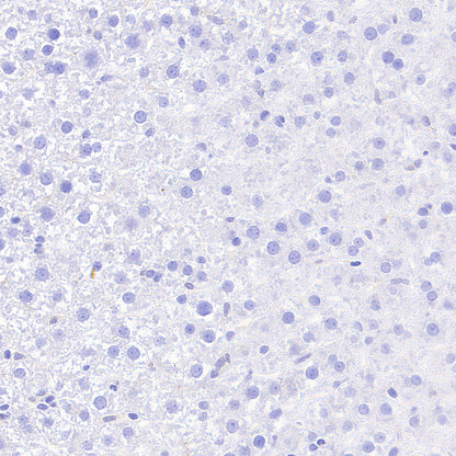 PITX2 Recombinant Rabbit mAb (S-4009-54)