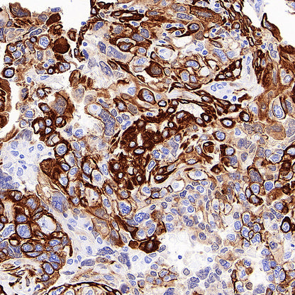 Cytokeratin 7 Recombinant Rabbit mAb (S-5954)