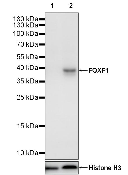 FOXF1 Recombinant Rabbit mAb (S-2808-1)