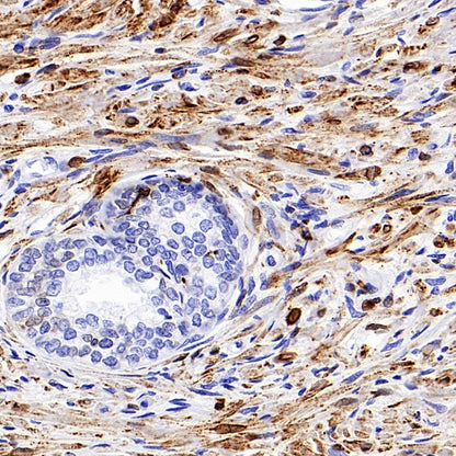 COX1/Cyclooxygenase 1 Recombinant Rabbit mAb (S-1478-48)