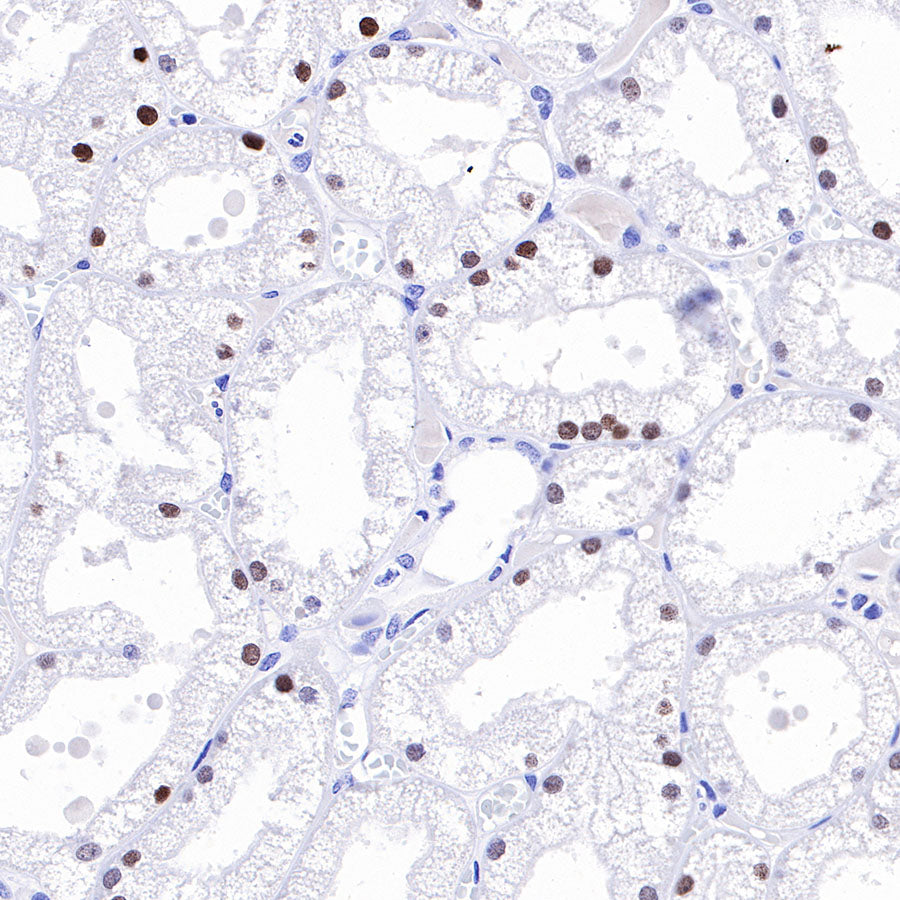 HNF4α Recombinant Rabbit mAb (SDT-373-64)