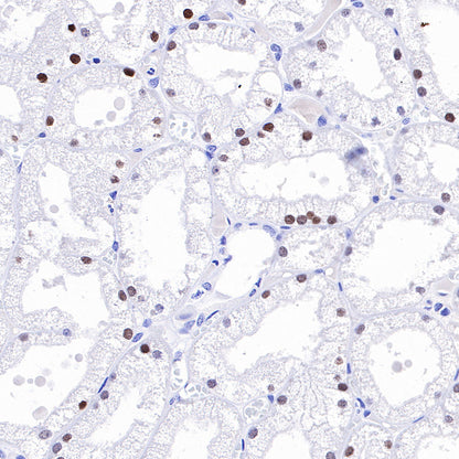 HNF4α Recombinant Rabbit mAb (SDT-373-64)