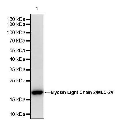 Myosin Light Chain 2/MLC-2V Rabbit Polyclonal Antibody