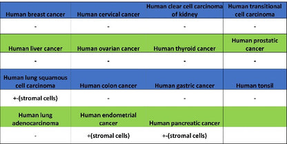 TGF beta 1 Recombinant Rabbit mAb (S-3204)
