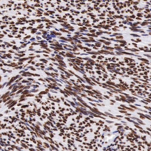 Histone H3 (tri methyl K27) Recombinant Rabbit mAb (SDT-431-118)