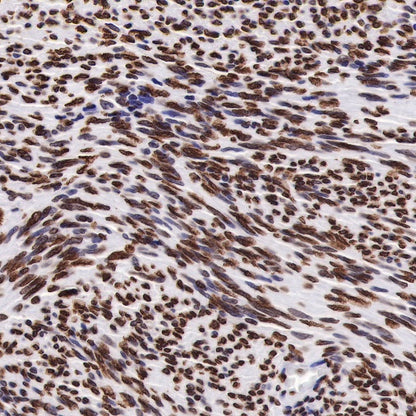 Histone H3 (tri methyl K27) Recombinant Rabbit mAb (SDT-431-118)