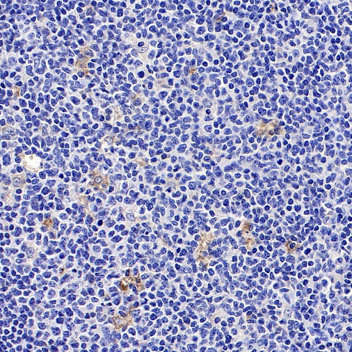CHI3L1 Recombinant Rabbit mAb (S-324-38)