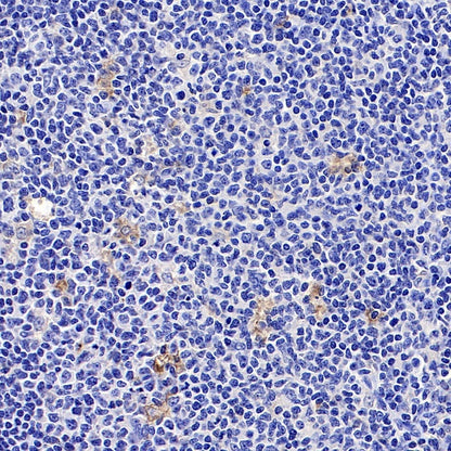 CHI3L1 Recombinant Rabbit mAb (S-324-38)