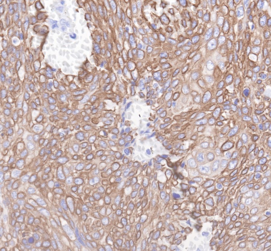 Cytokeratin 19 Recombinant Rabbit  mAb,PBS Only (SDT-107-19)
