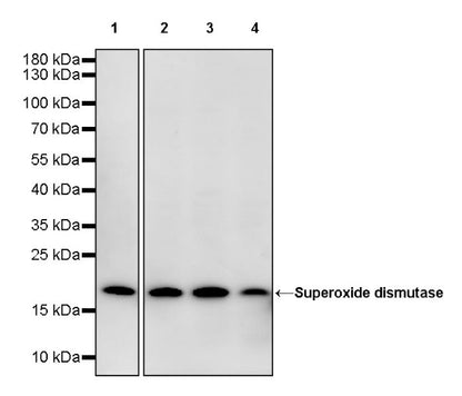 Superoxide dismutase Rabbit Polyclonal Antibody