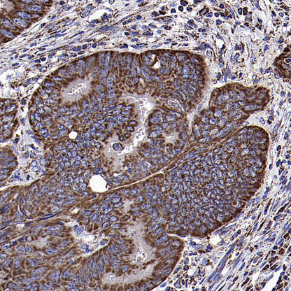 CYTB Recombinant Rabbit mAb (S-3877-15)