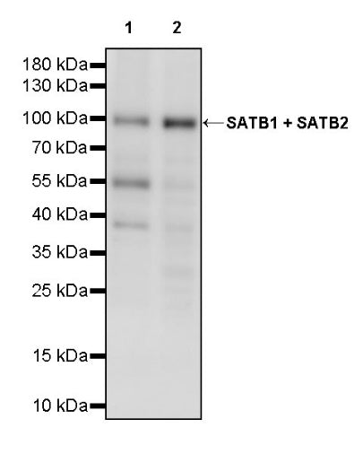 SATB1 + SATB2 Recombinant Mouse mAb (S-3382)