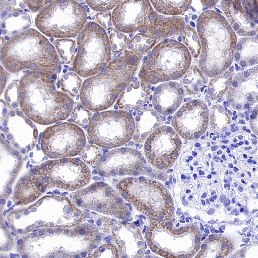 CHCHD10 Recombinant Rabbit mAb (S-4106-13)