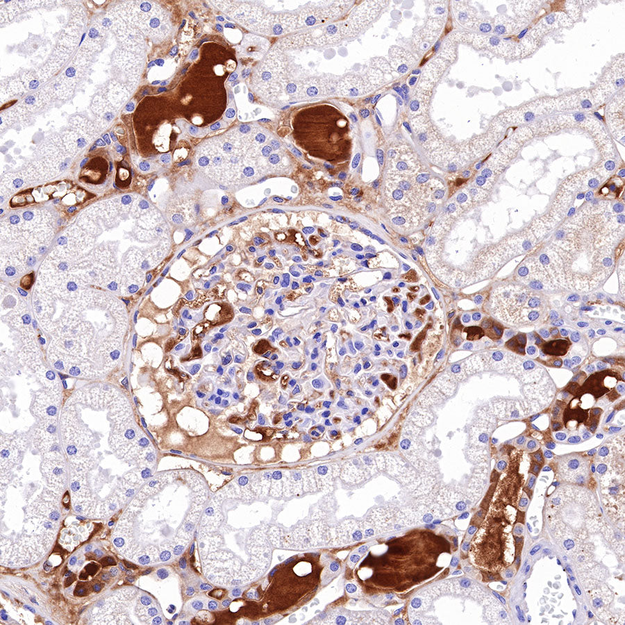C4d Recombinant Rabbit mAb (SDT-330-2)