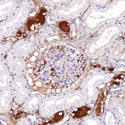 C4d Recombinant Rabbit mAb (SDT-330-2)