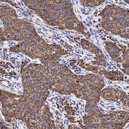 VDAC1 Recombinant Rabbit mAb (S-1877-18)
