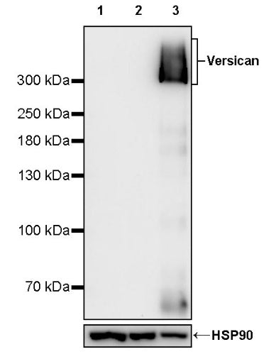 Versican Recombinant Rabbit mAb (S-3770-43)