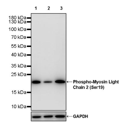 Phospho-Myosin Light Chain 2 (Ser19) Recombinant Rabbit mAb (S-3335-18)