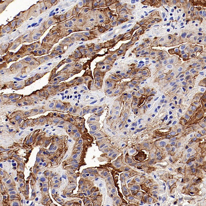 CD57 Mouse mAb (S-R571)