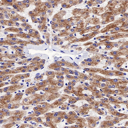 SQSTM1/p62 Recombinant Rabbit mAb (S-R346)