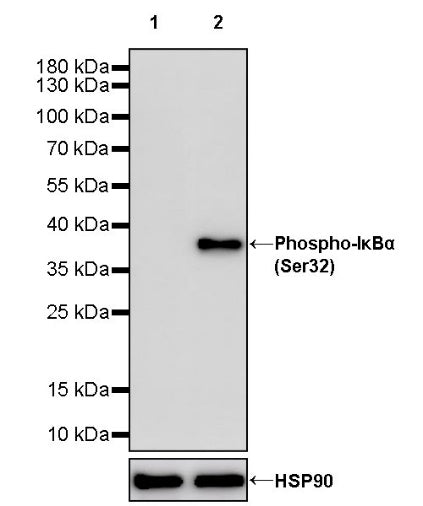 Phospho-IκBα (Ser32) Recombinant Rabbit mAb (S-1084-395)