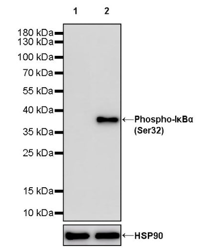Phospho-IκBα (Ser32) Recombinant Rabbit mAb (S-1084-395)
