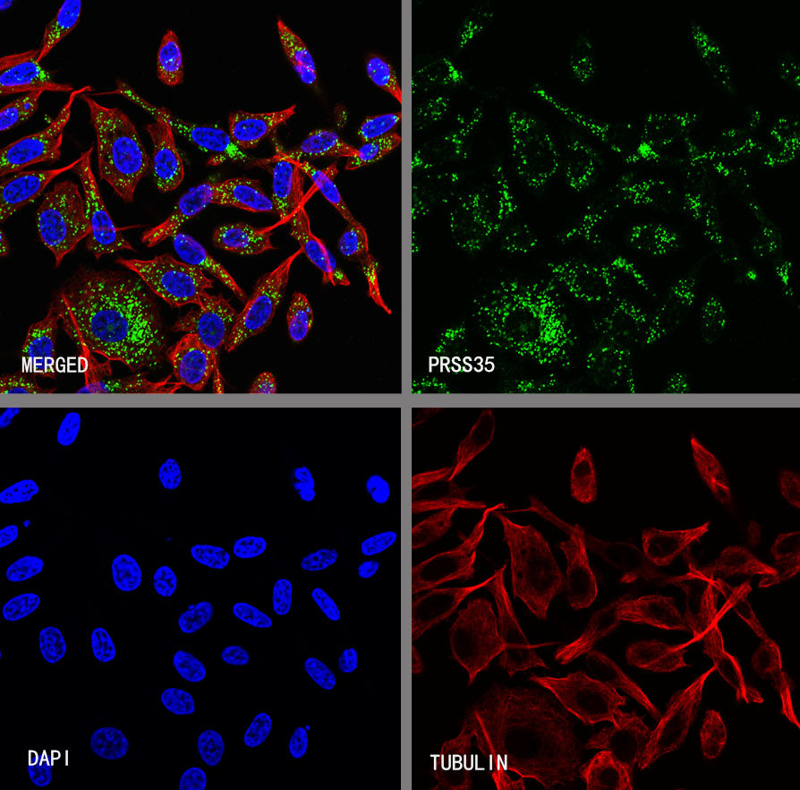 PRSS35 Recombinant Rabbit mAb (S-3769-241)