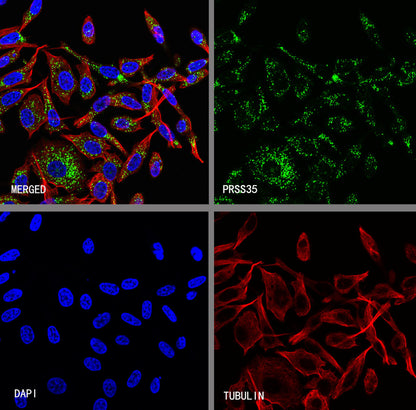 PRSS35 Recombinant Rabbit mAb (S-3769-241)