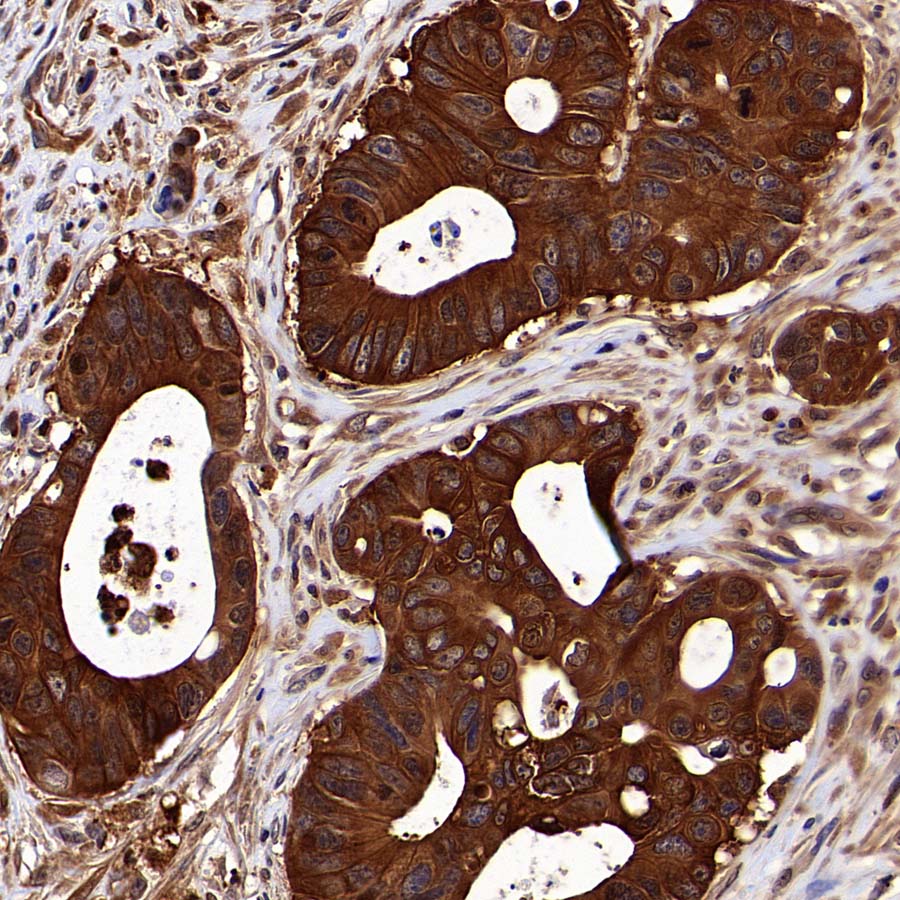 Aldolase A Recombinant Rabbit mAb (S-4007-23)
