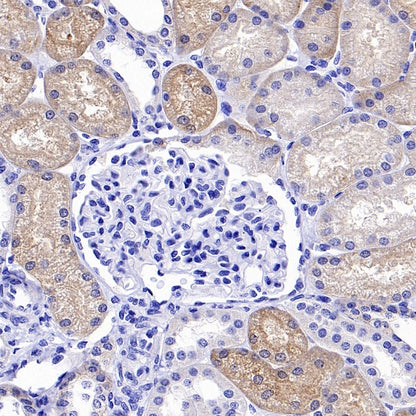 TRPV4 Recombinant Rabbit mAb (S-1746-65)