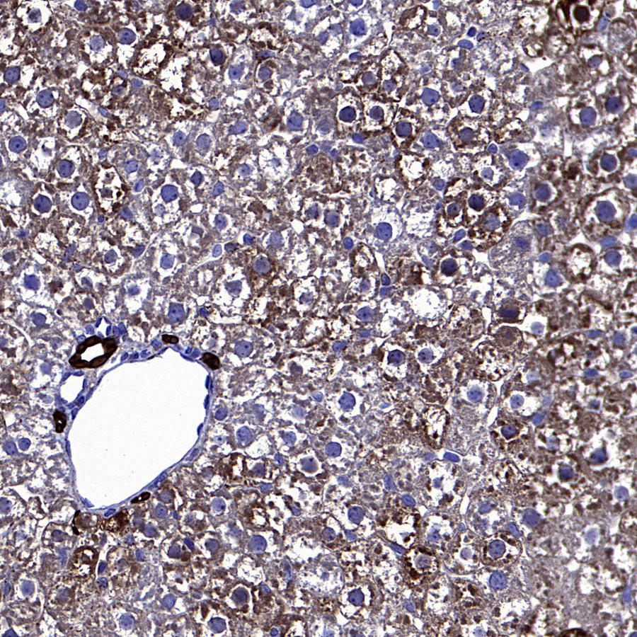 ALDH2 Recombinant Rabbit mAb (S-4173-20)