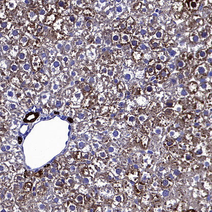 ALDH2 Recombinant Rabbit mAb (S-4173-20)