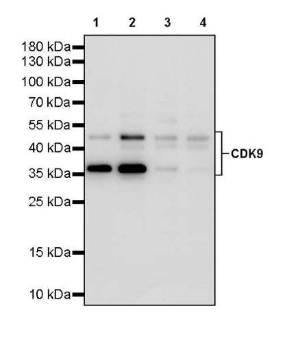 CDK9 Recombinant Rabbit mAb (S-2661-10)
