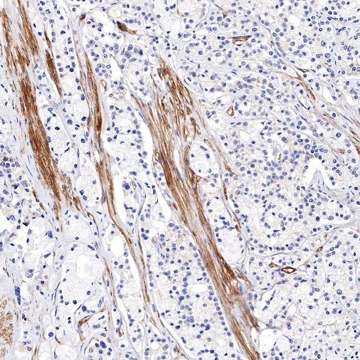 Paxillin Recombinant Rabbit mAb (S-619-12)