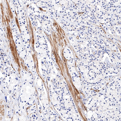 Paxillin Recombinant Rabbit mAb (S-619-12)