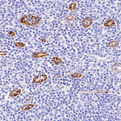 SPARCL1 Recombinant Rabbit mAb (S-3326-27)