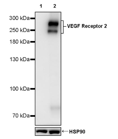 VEGF Receptor 2 Recombinant Rabbit mAb (S-3912-20)