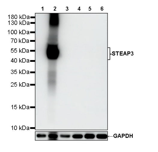 STEAP3 Recombinant Rabbit mAb (S-4466-26)