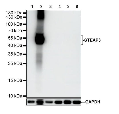 STEAP3 Recombinant Rabbit mAb (S-4466-26)