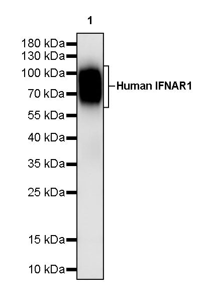 Anti-Human IFNAR1 Monoclonal Antibody (Anifrolumab)