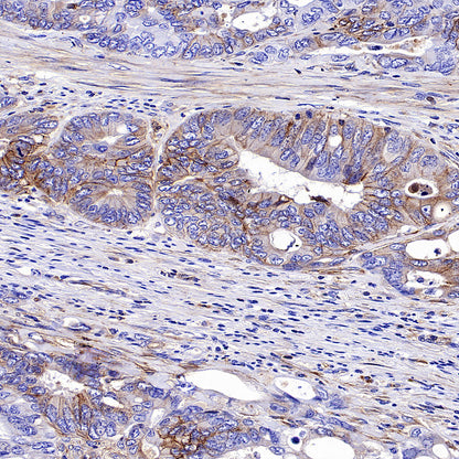 PTK7 Recombinant Rabbit mAb ,PBS Only(SDT-2432-136)
