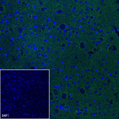 MAP2 Recombinant Rabbit mAb, PBS Only (SDT-2060-28)
