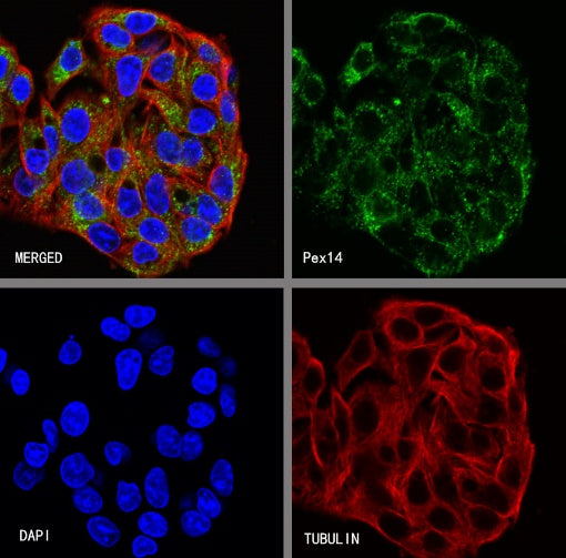 Pex14 Recombinant Rabbit mAb (S-2379-8)