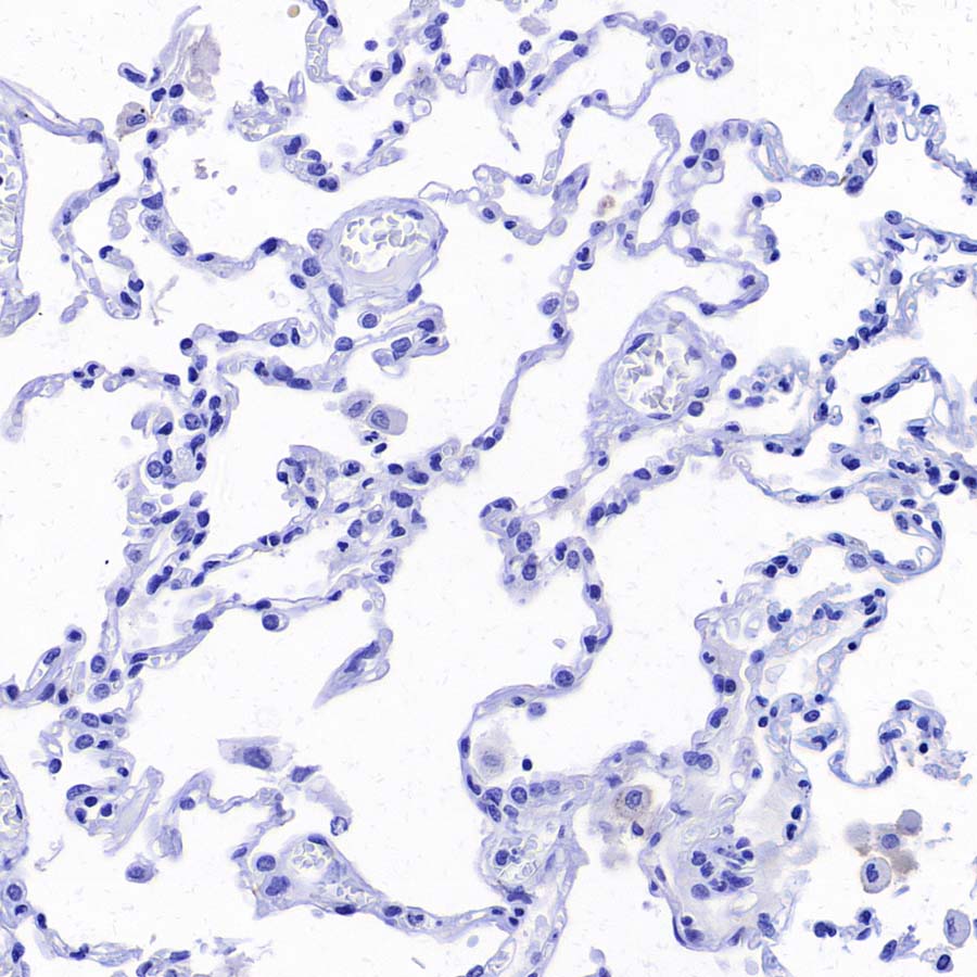 ABCC1/MRP1 Recombinant Rabbit mAb (SDT-4056-11)