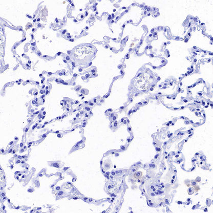 ABCC1/MRP1 Recombinant Rabbit mAb (SDT-4056-11)