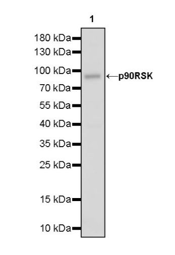 p90RSK Recombinant Rabbit mAb (S-1024-26)
