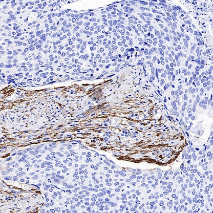 TAGLN/Transgelin Recombinant Rabbit mAb (S-1715-59)