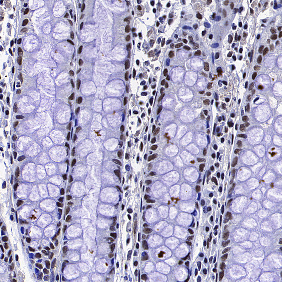 Caspase-8 Recombinant Rabbit mAb (S-2676-121)