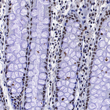 Caspase-8 Recombinant Rabbit mAb (S-2676-121)