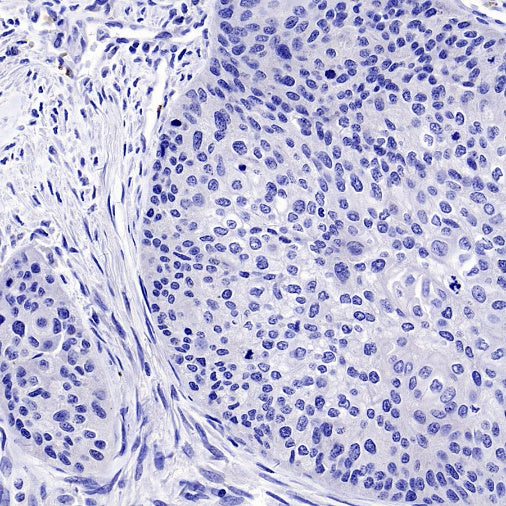 SOX11 Recombinant Mouse mAb (SDT-919-58)